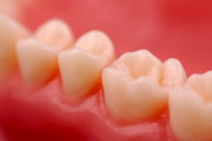 Gum Disease